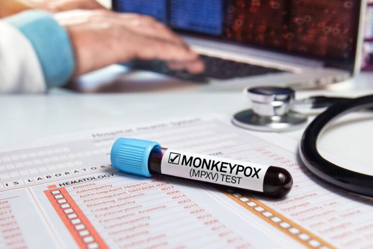 Monkeypox virus test