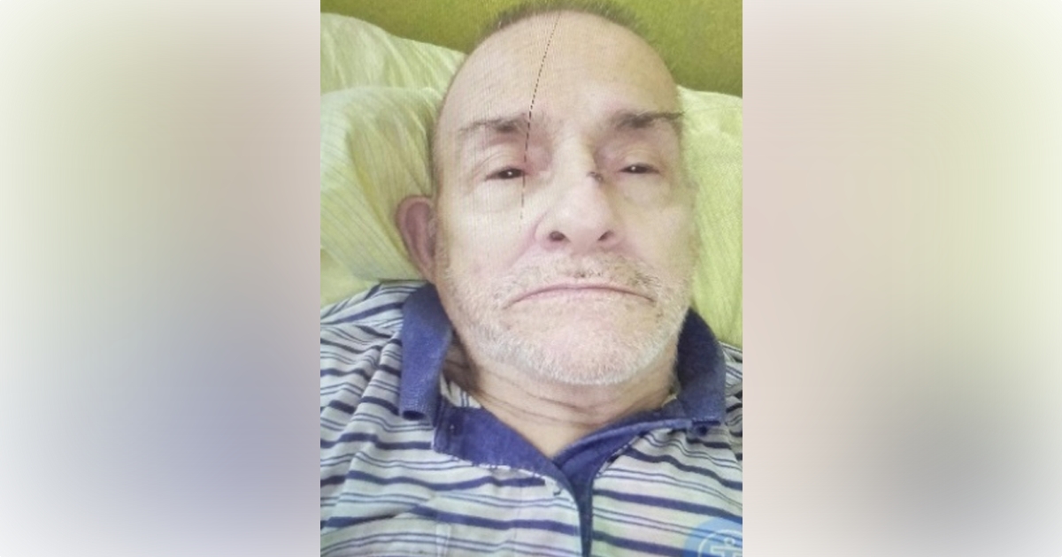 Candido Mantalvo