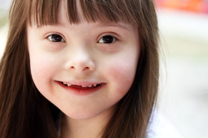 Girl with down syndrome