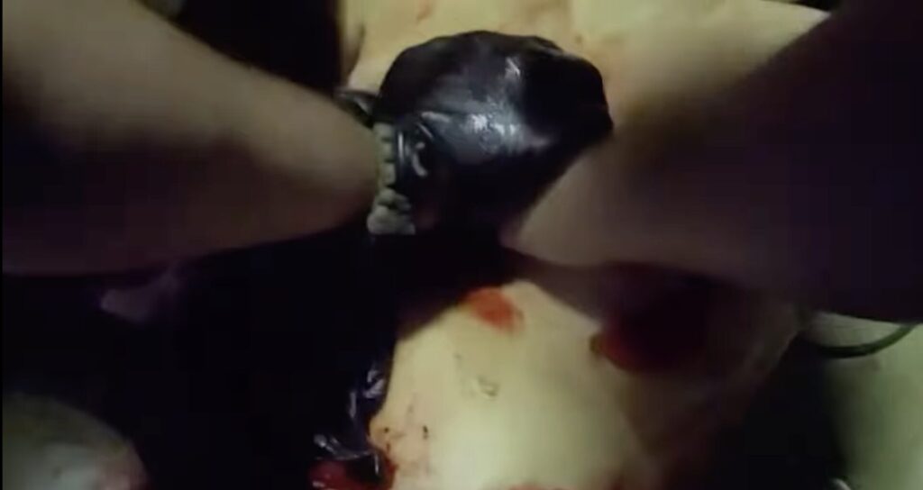 Body camera footage shows officers attempting life-saving measures